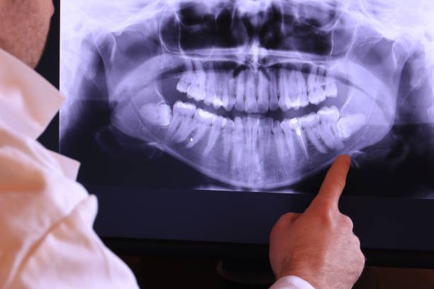 Best Emergency Dentist for Knocked-Out Tooth in Glade Spring, VA