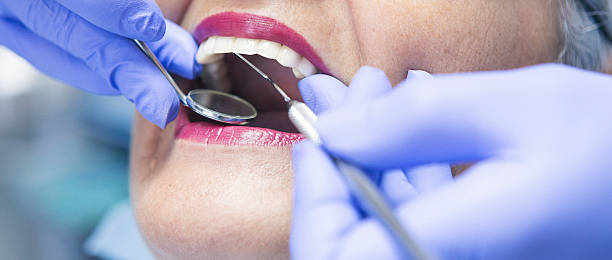 Best Emergency Dentist for Special Needs Patients in Glade Spring, VA